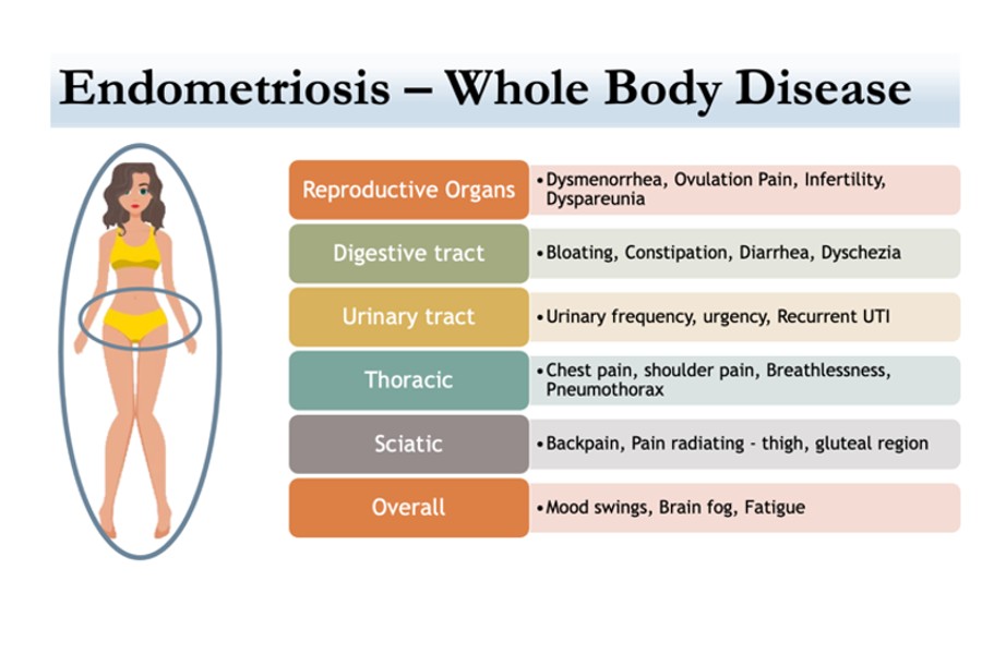 Endometriosis Surgeon in Dubai, UAE